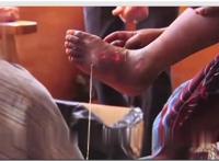 世界10大最恶心的寄生虫，龙线虫最恶心(一条长几十厘米)