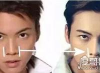 陈伟霆整容前后照片对比，整体变化太大但其实并没有整容