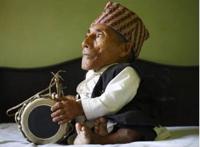 世界上最小的脚，也是世界上最矮的人(高54.6/脚长5厘米)