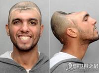 半脑哥卡洛斯不但存活下来，少了半个脑袋的他智商还非常高