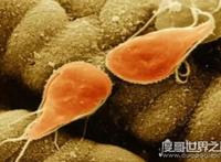 景区玩水被吃脑虫(阿米巴原虫)入侵，引发脑膜脑炎终不治生亡