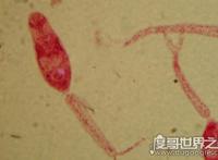 恐怖的吸血虫图片，以人血液为食寄生数十年能致死