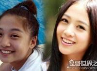 鬼鬼吴映洁整容前后照片对比，大方承认在韩国微整