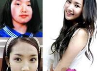韩国女星朴敏英整容前后照片对比，丑女大翻身(整容前丑爆了)