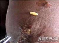 莲蓬乳是什么？像莲蓬一样的乳房竟是真的存在(慎入)