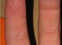 恶心反胃的蓬蓬乳和空空指，实际是PS出来的密集恐惧症图