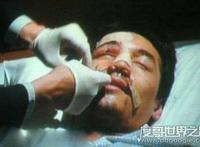 胡歌车祸原因诡异，胡歌车祸前后照片对比遭毁容