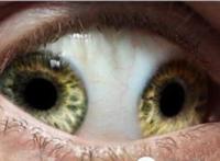 世界上有双瞳的人吗，双瞳孔是真实存在(我国就有不少)