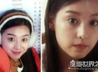 金智媛整容前后照片对比，16岁被星探发掘微整过