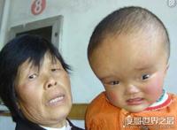 安徽阜阳大头娃娃事件，无良商家生产劣质奶粉害死无辜婴儿