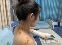 南京一女子被室友追求者捅刀，室友前往医院探望一次后失去联系