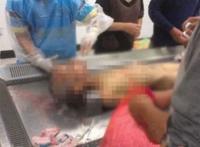 9·20河南挖眼抛尸案，九岁男童两眼球破裂塌陷