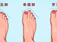 希腊脚，希腊脚是什么