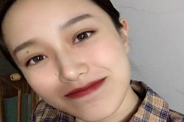 去鼻唇沟的方法 怎么去除鼻唇沟