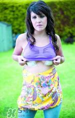 假体隆胸取出后图片 隆胸假体取一月图片