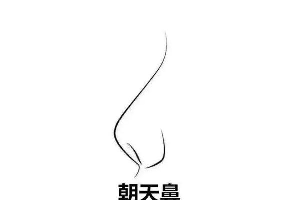 朝天鼻矫正算整容吗 朝天鼻可以整容吗
