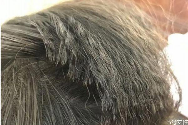 发根烫能保持多久 发根烫是什么样子