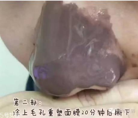 去黑头哪个牌子好 去黑头最好的面膜2022