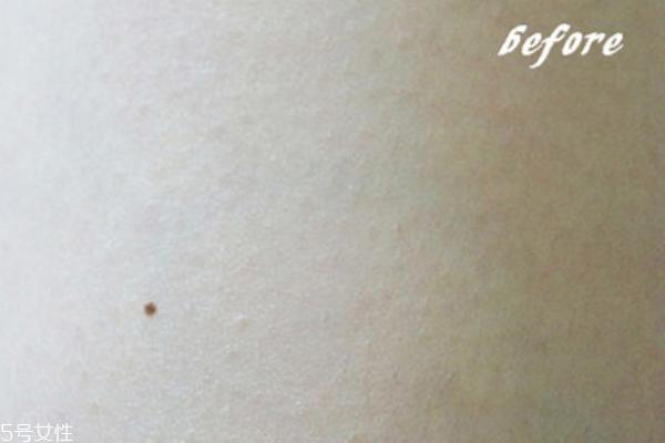 beely身体乳怎么样 鸡皮的好选择