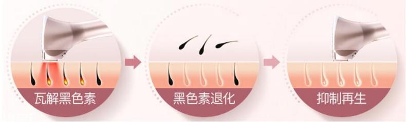 彩光脱毛安全吗 彩光脱毛能永久脱毛吗