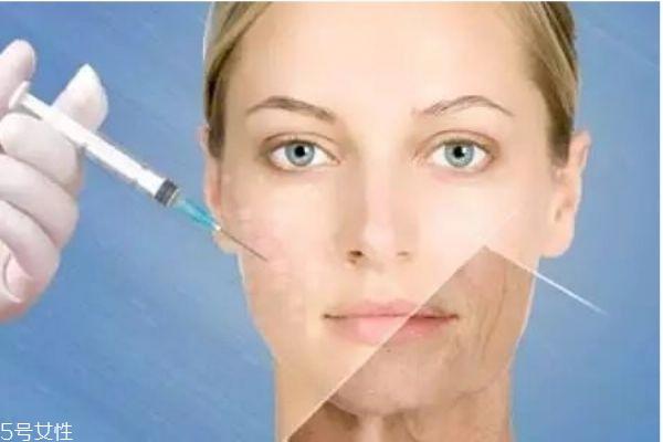 什么办法除皱最好 祛皱的最好方法