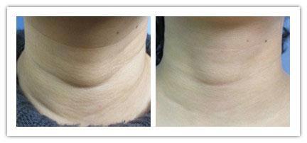 怎么化妆又快又好 超简单十分钟化妆教程