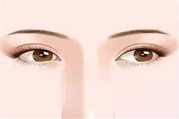 美杜莎双眼皮是噱头吗 美杜莎双眼皮好吗