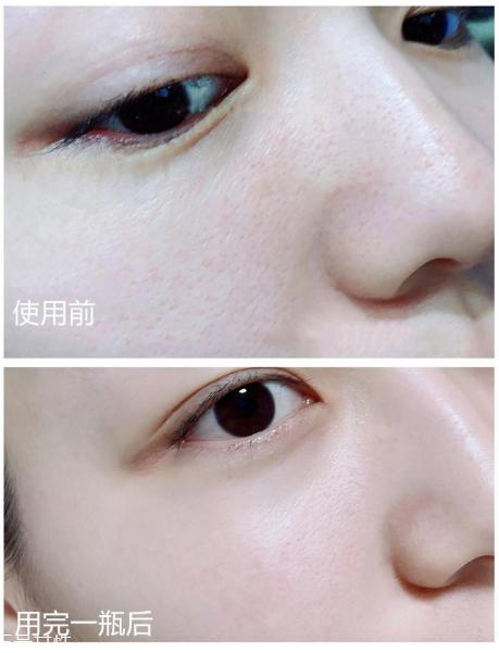 evidens超级面膜怎么样 evidens超级面膜成分