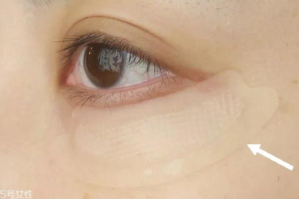 微针眼膜能天天使用吗 一个礼拜用一次