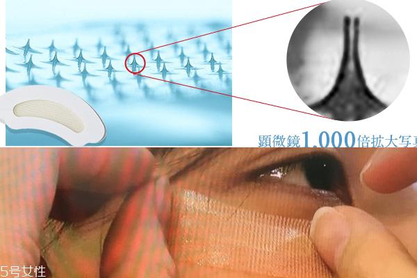 微针眼膜能天天使用吗 一个礼拜用一次