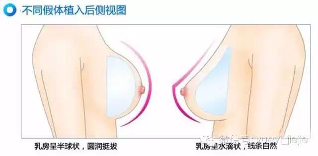 完美胸型标准是什么样的及示意图 从E罩杯柳岩开讲
