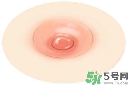 乳头发黑怎么办?怎么样可以使乳头变白?