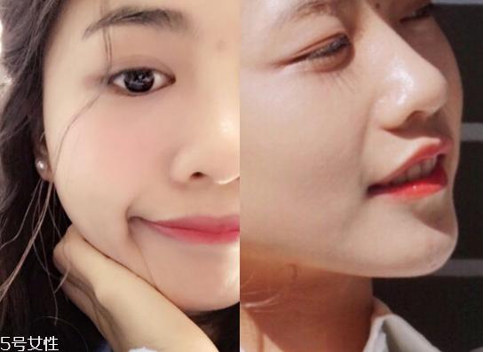 tripollar stop童颜机好用吗 tripollar stop美容仪怎么用