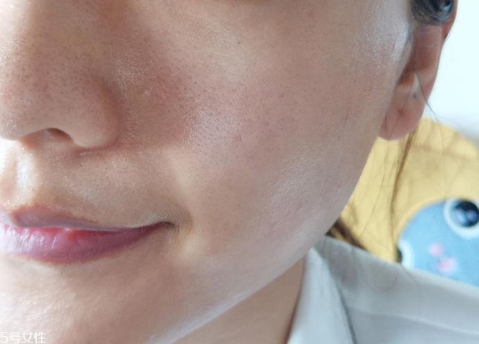 tripollar stop童颜机好用吗 tripollar stop美容仪怎么用