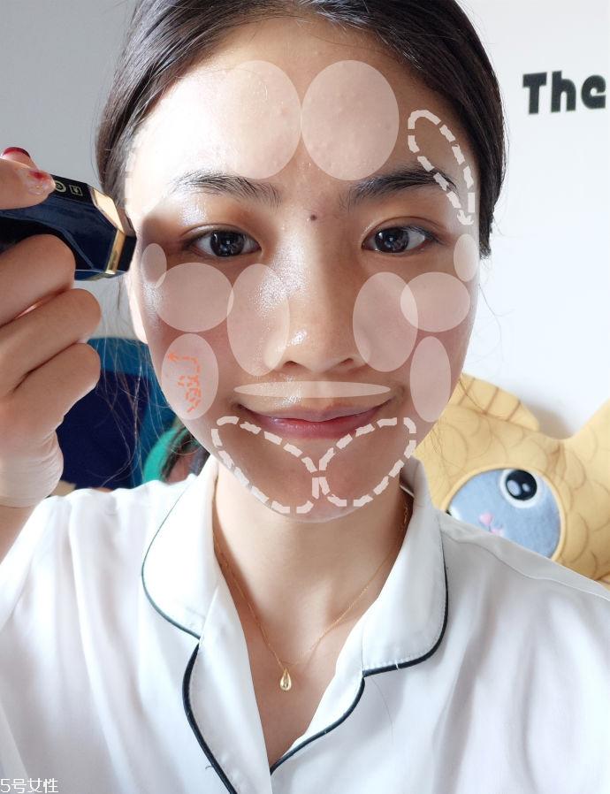 tripollar stop童颜机好用吗 tripollar stop美容仪怎么用