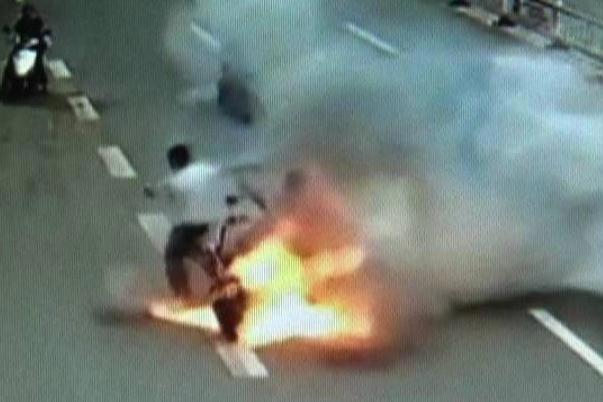 电瓶车行驶中爆燃 烧伤女孩病危