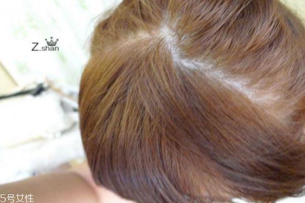 栗棕色适合什么年龄染 栗棕色染发效果图