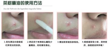 the body shop茶树精油怎么用?美体小铺茶树精油怎么打开