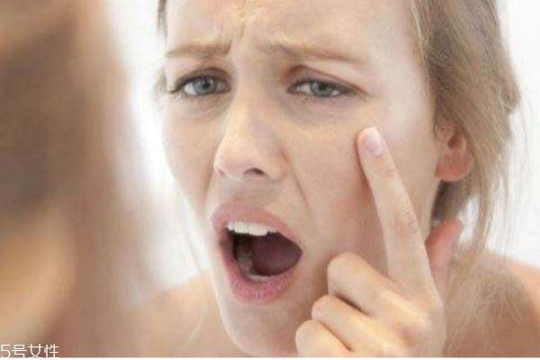 电波拉皮术疼吗 电波拉皮的除皱效果如何