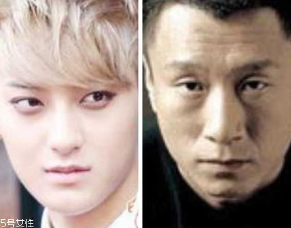 死鱼眼怎么治？割双眼皮可以治死鱼眼