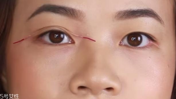 双眼皮纤维条怎么用 教你堪比动手术的方法