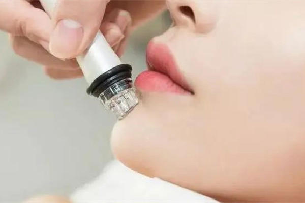 胶原蛋白填充粉真的有效果吗 胶原蛋白填充粉的用法