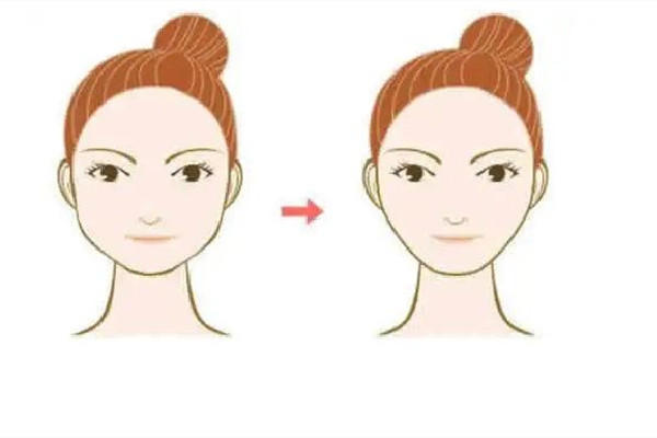 胶原蛋白填充粉真的有效果吗 胶原蛋白填充粉的用法