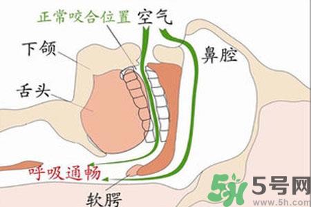鼻子红是什么原因?鼻子红怎么办?