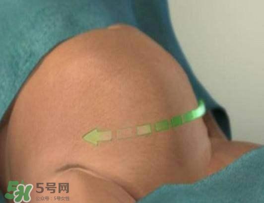 剖腹产的过程 剖腹产的步骤及时间