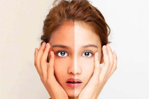 美白针真的可以全身美白吗 美白针是永久性的吗