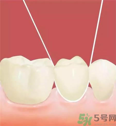 牙线会使牙缝变大吗?牙线会让牙缝变大吗?