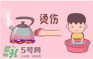 烫伤可以用牙膏吗?烫伤用牙膏管用吗?