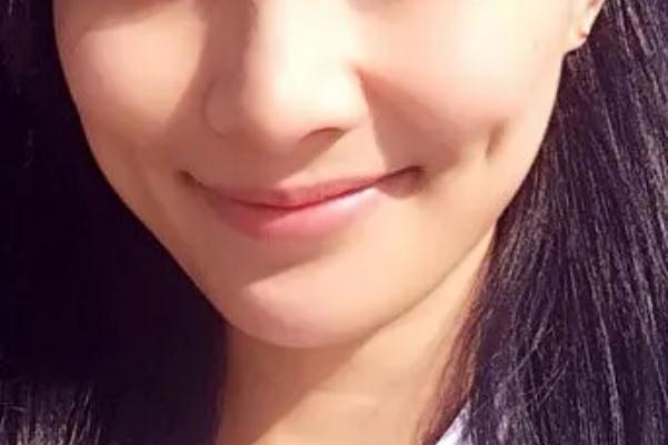 人造酒窝有后遗症吗 人造酒窝多久恢复自然