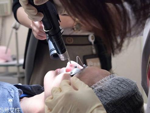 皮秒多少钱一次 具体价格需咨询